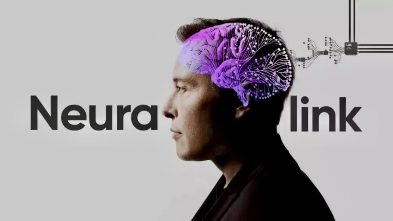 Neuralink pimeä puoli: Elon Musk aivoimplantteja kehittävä yritys tappoi useita apinoita kokeillessaan ensimmäisiä mallejaan.